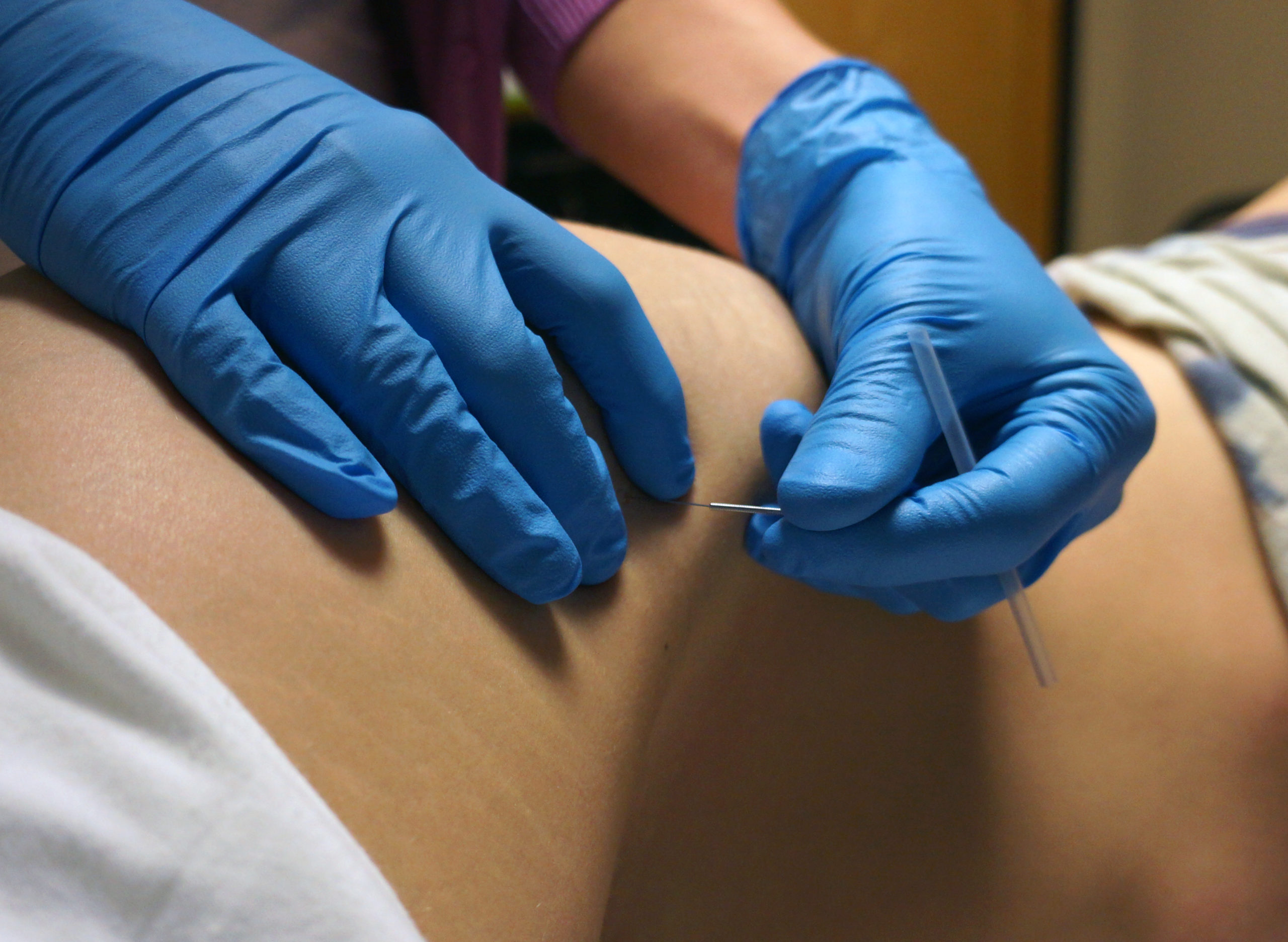 Figure-11.4-DN-TFL-muscle-scaled